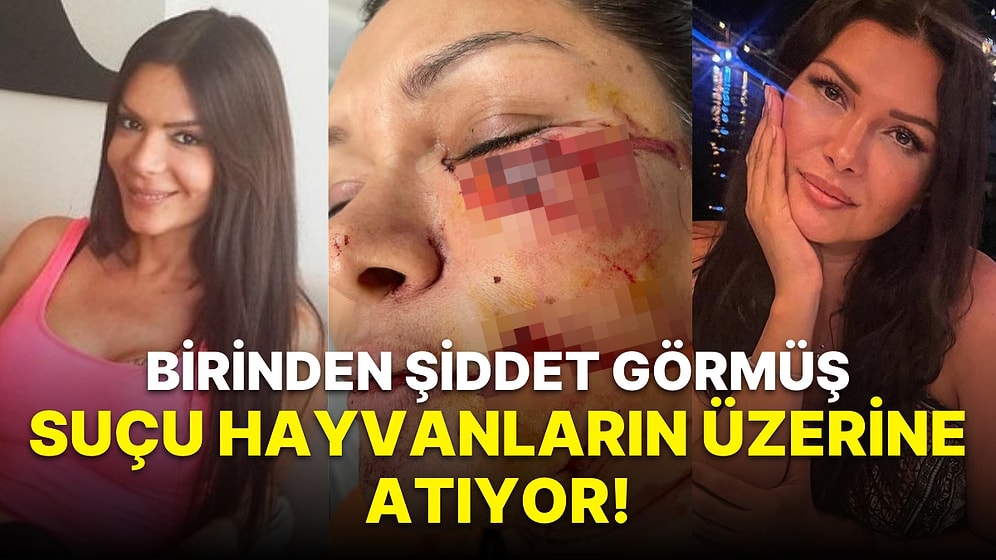 Sevda Demirel, Köpek Saldırısına Uğrayan Tuğba Altıntop'un Hemcinsinden Şiddet Gördüğünü İddia Etti!