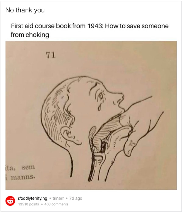 Эта иллюстрация первой помощи 1943 года, которая ОЧЕНЬ ошибочно советует людям засовывать палец в горло тому, кто подавился: