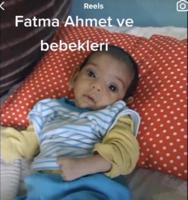 Esra Erol'da programına annesi Melahat Oruç'la birlikte katılan Fatma, bebeğin hastaneye kaldırıldığını ve bebeğin doğduğundan beri yıkanmadığını ve bu nedenle de ayağından mikrop kaptını söyledi.