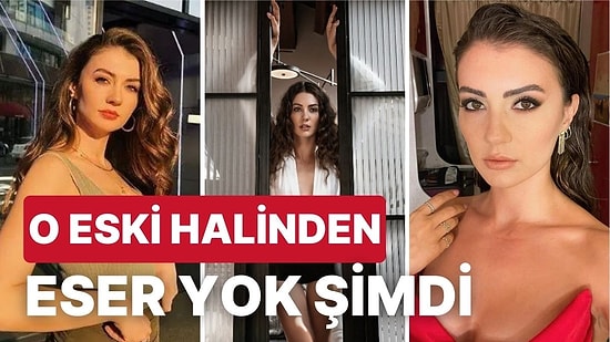 Estetikli mi? Burcu Özberk'in Ünlü Olmadan Önceki ve Oyunculuğunun İlk Yıllarındaki Halleri Kafa Karıştırdı