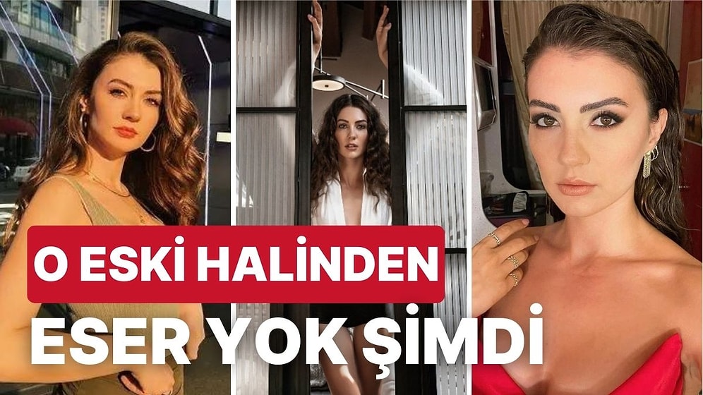 Estetikli mi? Burcu Özberk'in Ünlü Olmadan Önceki ve Oyunculuğunun İlk Yıllarındaki Halleri Kafa Karıştırdı