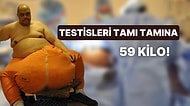 59 Kilo Testisleriyle Akıllara Durgunluk Veren Adamı Görünce Ufak Çaplı Bir Şok Geçireceksiniz!