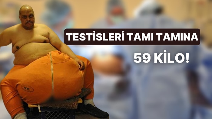 59 Kilo Testisleriyle Akıllara Durgunluk Veren Adamı Görünce Ufak Çaplı Bir Şok Geçireceksiniz!