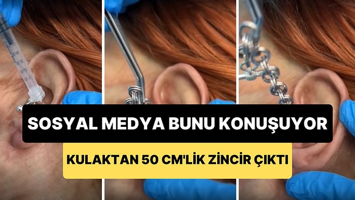 Sosyal Medyanın Konuştuğu Bi' Acayip Görüntü: Kulağın İçinden Çıkartılan 50 Cm'lik Zincir Görüntüsü Viral Oldu