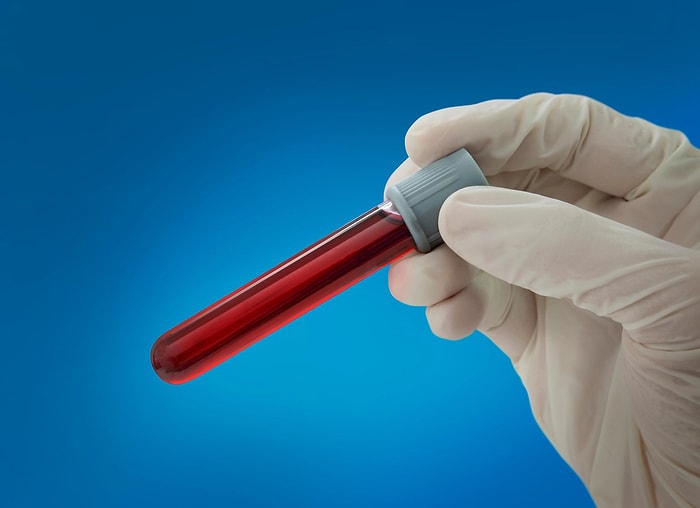 Впервые в истории: британские ученые транспортировали человеку кровь, полученную в лаборатории