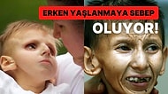 Nadir Görülen Bir Hastalık Olan Cockayne Sendromu ve Belirtileri Nelerdir?