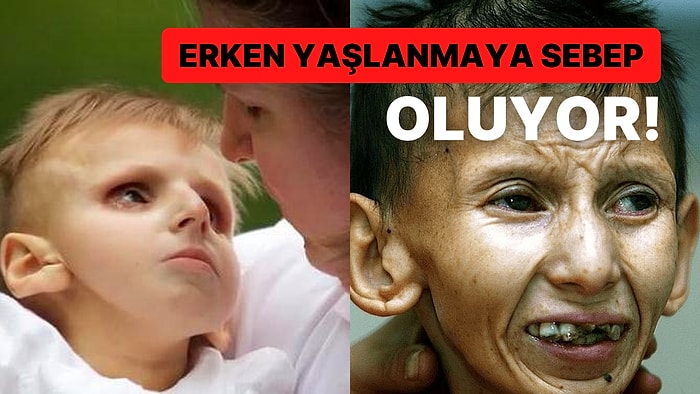 Nadir Görülen Bir Hastalık Olan Cockayne Sendromu ve Belirtileri Nelerdir?