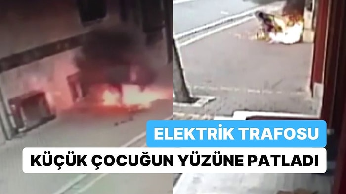 Elektrik Trafosuna Çatal Sokan 4 Yaşındaki Çocuk Ağır Yaralandı