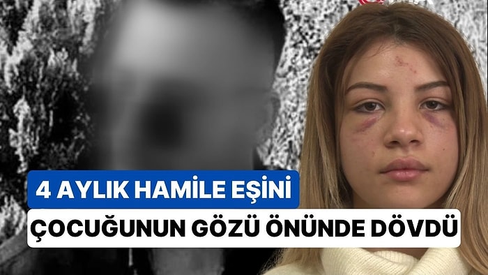 'Babalık Testi Fiyatı' Yüzünden Kavga Ettiler, Hamile Eşini Çocuğunun Gözü Önünde Dövdü: "Ölmek İstemiyorum"