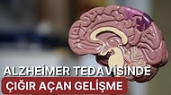 Araştırmalar Deneysel Bir İlacın Alzheimer Hastalarında Bilişsel Gerilemeyi Yavaşlattığını Ortaya Koydu