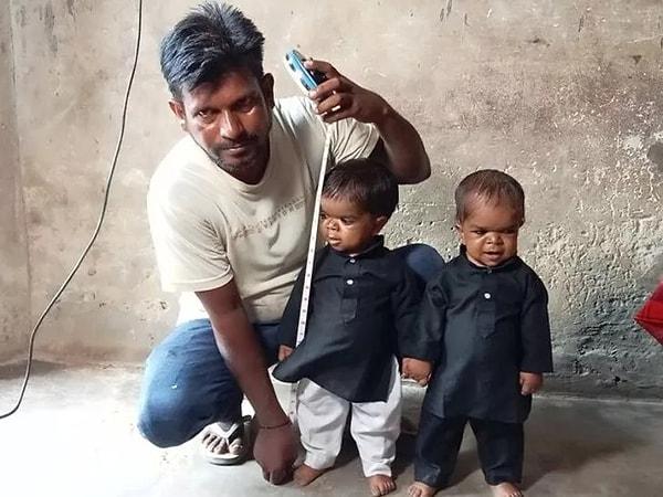 Hindistan'ın Punjab kentinde yaşayan ve isimleri Daljeet, Kamaljit ve Ramneet Singh olan üç kardeşin boyu 50 santimetre.