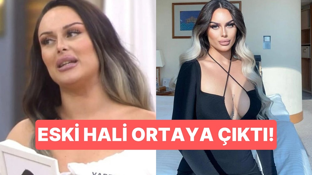 Kısmetse Olur'un Gelin Adayı Yaren Dağ'ın Estetiksiz Eski Hali Ortaya Çıktı!