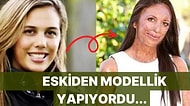 Vücudunun Yüzde 65'i Yanan Kadının İlham Veren Mücadelesi: "Savaşçı Bir Ruhum Var!"