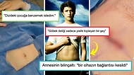 Göbek Deliğini Aldıran Adamın Ameliyat Olma Nedeni, İnternet Alemine Akıl Tutulması Yaşattı