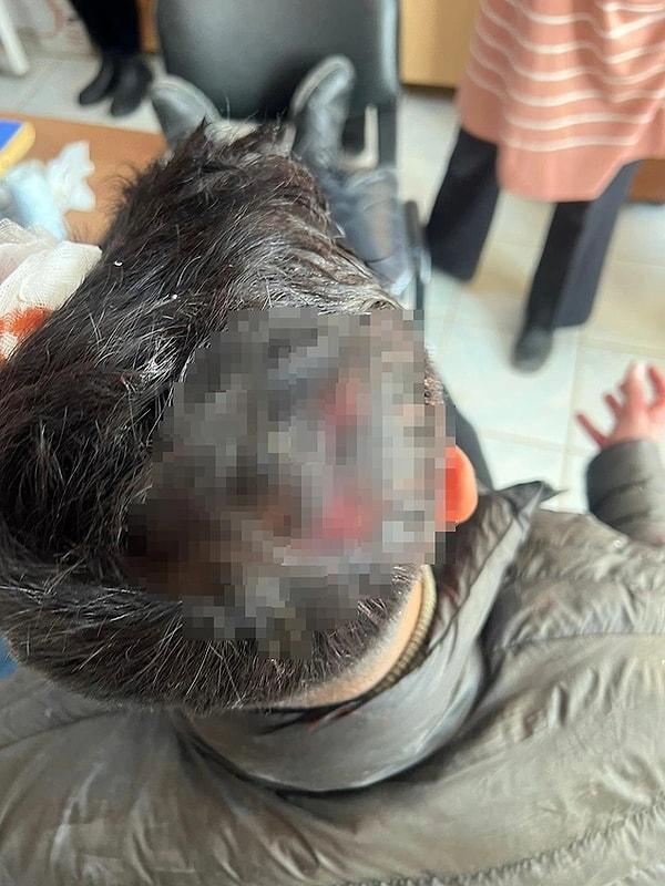 10. Diyarbakır'ın Çınar ilçesinde 28 yaşındaki sınıf öğretmeni Mehmet Gümüş, öğrencisinin ailesinin taşlı saldırısına uğradı. Başına dikiş atılan öğretmen, aileden şikayetçi oldu.