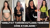 Kilo Vermek İçin Midesinin Yarısını Aldıran Kadının Şok Edici Açıklamaları: "Tekrar Yemek Yiyebilmek İçin..."