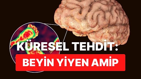 Hepimizin Yeni Kabusu: Beyin Yiyen Amip Nedir? Beyin Yiyen Amip Belirtileri Nelerdir, Nasıl Bulaşır?