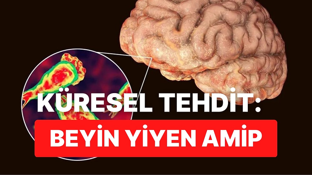 Hepimizin Yeni Kabusu: Beyin Yiyen Amip Nedir? Beyin Yiyen Amip Belirtileri Nelerdir, Nasıl Bulaşır?