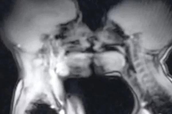 Bir hastanenin MR cihazında cinsel ilişkiye giren çiftin görüntüleri, genel geçer bir bilginin doğruluğunu ortadan kaldırdı.