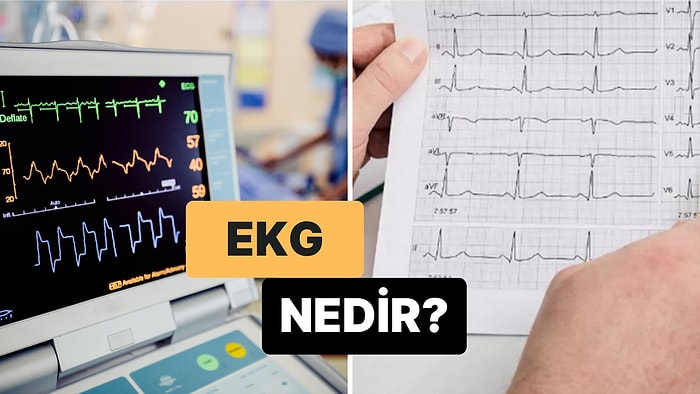 Kalpteki Elektrik Sinyallerini Grafiksel Olarak Kaydeden Bir Cihaz: EKG Nedir?