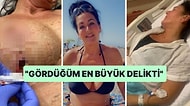 İngiltere'den Türkiye'ye Estetik İçin Geldikten Sonra Memesi Patlayan Kadının Yaşadıkları Kanınızı Donduracak