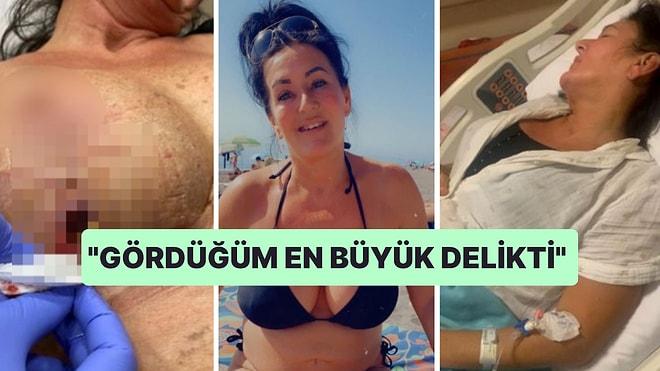 İngiltere'den Türkiye'ye Estetik İçin Geldikten Sonra Memesi Patlayan Kadının Yaşadıkları Kanınızı Donduracak