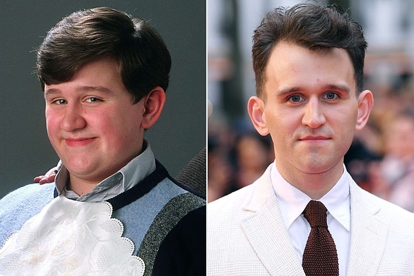 Harry Melling'in gözümüzün önünde muhteşem bir oyuncuya dönüşmesi hakkında siz ne düşünüyorsunuz peki?