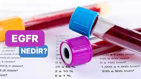 Böbreklerin Süzme Fonksiyonunu Ölçen Test: EGFR Nedir?