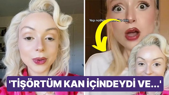 Kan Geldiğini Görünce Anladı: Bebeğini Emzirirken Meme Ucu Kopan Kadının Şoke Eden Hikayesi