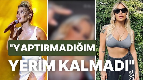 Meme Cevabıyla Gündeme Gelen Ünlü Şarkıcı İrem Derici Yaptırdığı Yeni Estetiğini Takipçileriyle Paylaştı