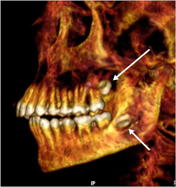Kalbi dışında hiçbir organı olmadığı, dişlerinin de tertemiz olduğu görülen Golden Boy mumyasının ilk olarak 1916’da Edfu şehrinin mezarlığı olan Nag el Hassaya’daki bir nekropolde keşfedildiği söyleniyor.
