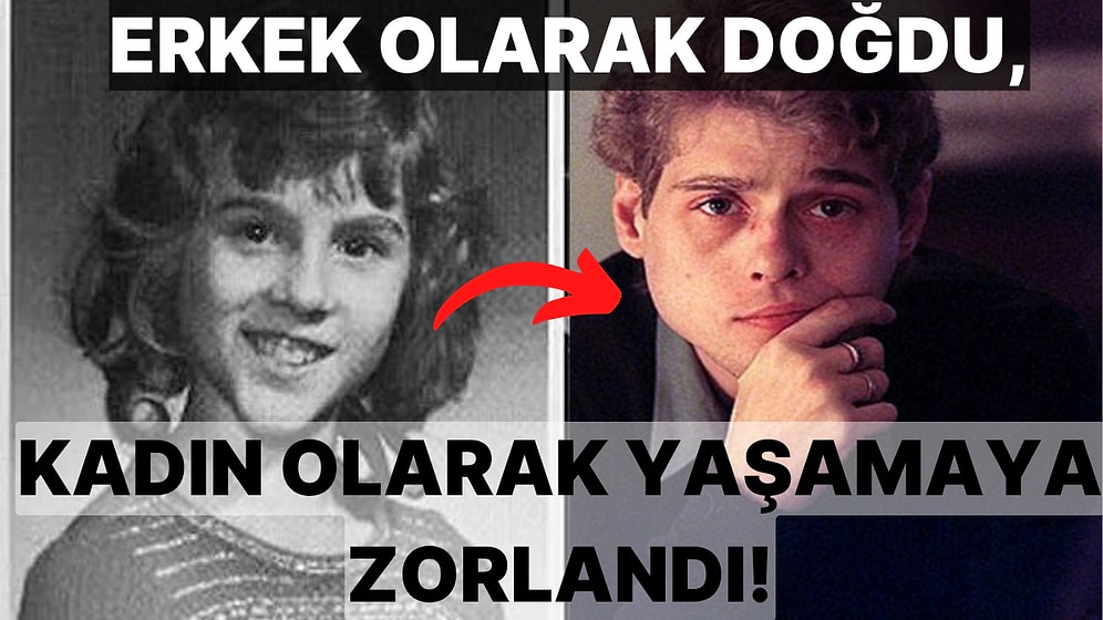 Tarihin En Korkunç Deneyi: Kendisinden Habersiz Cinsiyeti Değiştirilen Talihsiz Deneğin Üzücü Hikayesi