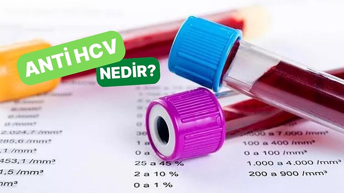 Hepatit C Virüsüne Karşı Bir Araya Getirilen Antikorları Araştıran Test: Anti HCV Nedir?