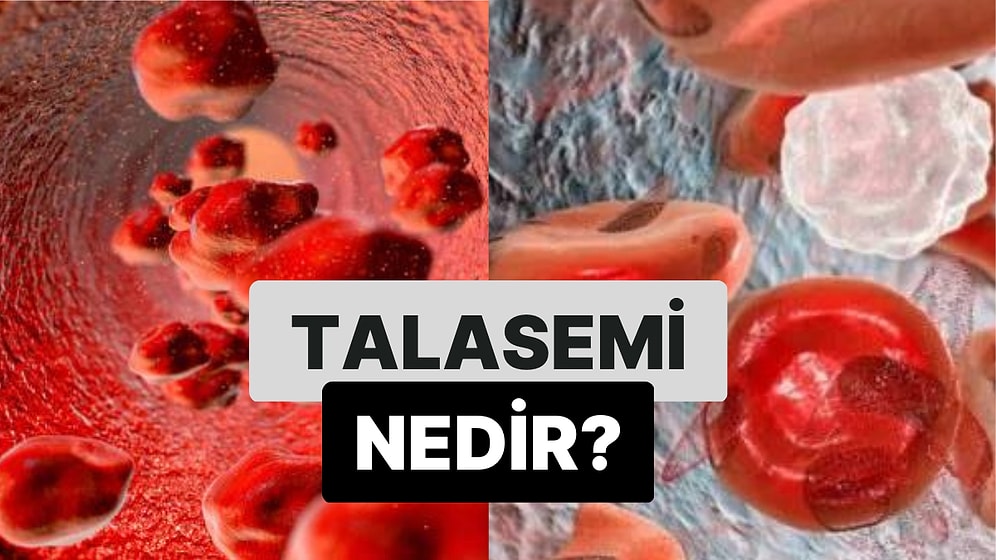 Akdeniz Anemisi Hastalığı: Talasemi Nedir?