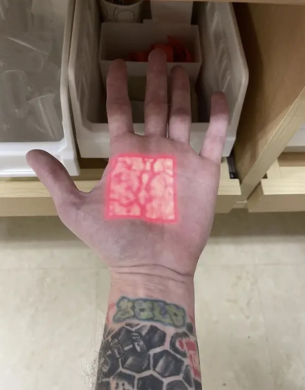 11. В некоторых больницах есть аппараты, которые позволяют врачам и медсестрам точно видеть, где находятся ваши вены.