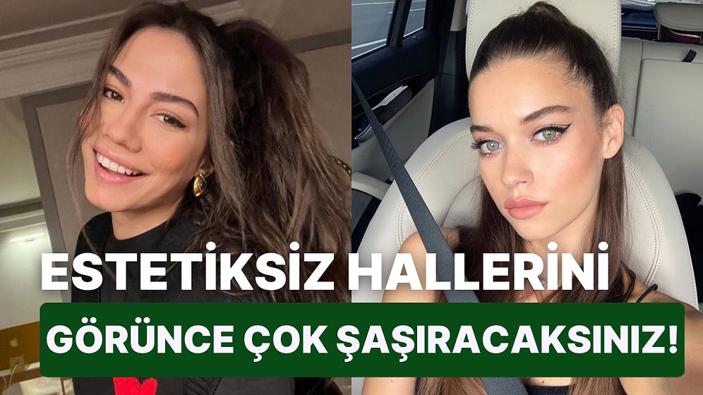 Yalı Çapkını'nın 'Pelo'sundan Bella Hadid'e Kadar: Son Zamanlarda Çok Konuşulan Ünlülerin Estetiksiz Halleri!