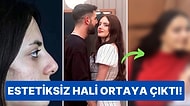 Kısmetse Olur'un En Beğenilen İsimlerinden Elif'in Yeni Ortaya Çıkan Estetiksiz Fotoğrafına Çok Şaşıracaksınız