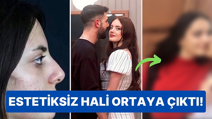 Kısmetse Olur'un En Beğenilen İsimlerinden Elif'in Yeni Ortaya Çıkan Estetiksiz Fotoğrafına Çok Şaşıracaksınız