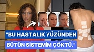 Bella Hadid, Hastalığı Hakkında İlk Kez Konuştu: "Her Gün Tedavisi Olmayan Acılar Çekiyorum!"