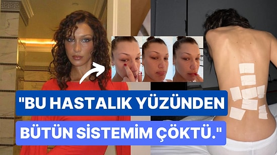 Bella Hadid, Hastalığı Hakkında İlk Kez Konuştu: "Her Gün Tedavisi Olmayan Acılar Çekiyorum!"