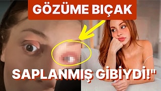 "Musluk Suyundan Bile Bulaşabilir!" Lens Yüzünden Gözüne Et Yiyen Bakteri Bulaşan Kadının Açıklamaları