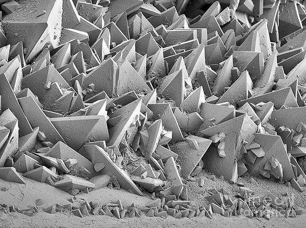 20. Bir elektron mikroskobu tarafından görüntülenen böbrek taşının yüzeyi👇