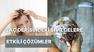 Saç Dibinde Çıkan Sivilcelerin Nedenlerini Anlatıyoruz