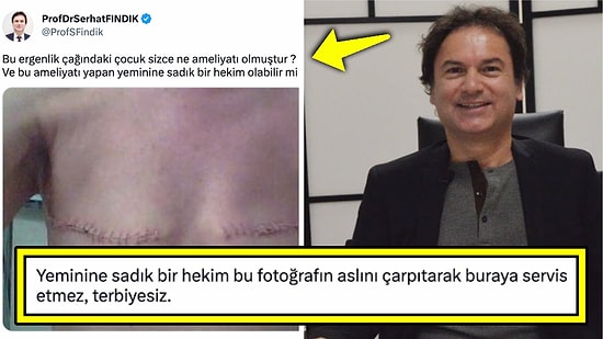 Meme Ameliyatını Sanki Cinsiyet Geçişi Gibi Paylaşan Profesör, LGBTİ+ Nefreti Yaydığı Gerekçesiyle Tepki Çekti