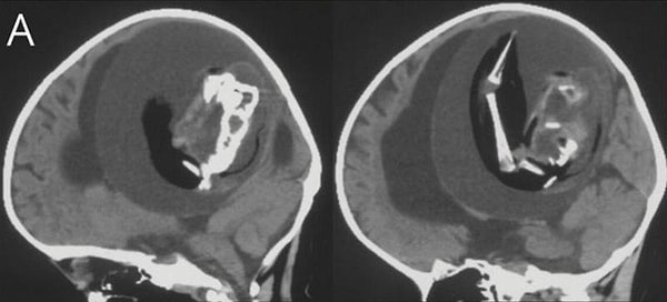 Ужасающее открытие