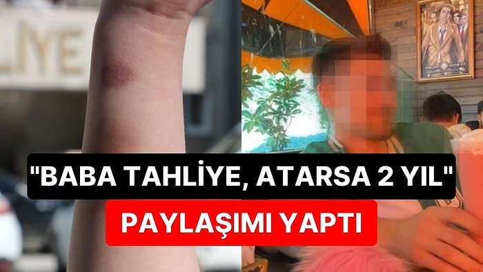 İlişki Teklifini Reddeden Sevgilisini Darbetti: "Baba Tahliye, Atarsa 2 Yıl"