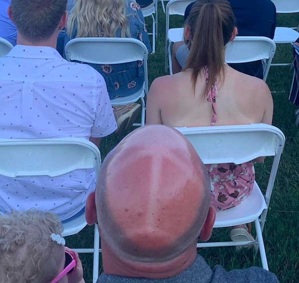 2. Интересный загарчик, конечно!