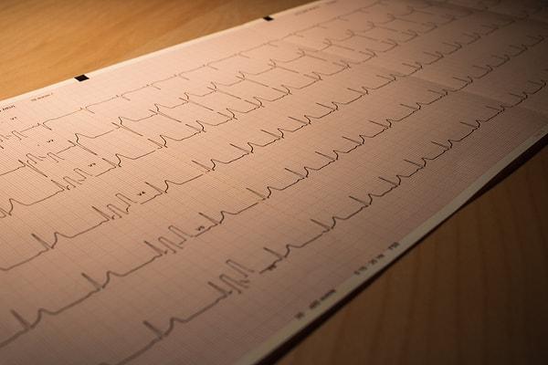 Sağlık Bakanlığı verilerine göre Türkiye'de her yıl yaklaşık 300 bin kişi kalp krizi geçirmekte.