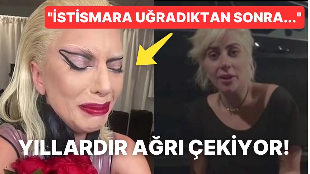 Turnelerini Bile İptal Etmişti: Lady Gaga'nın Yıllardır Pençeleştiği Kronik Hastalığı "Fibromiyalji" Nedir?