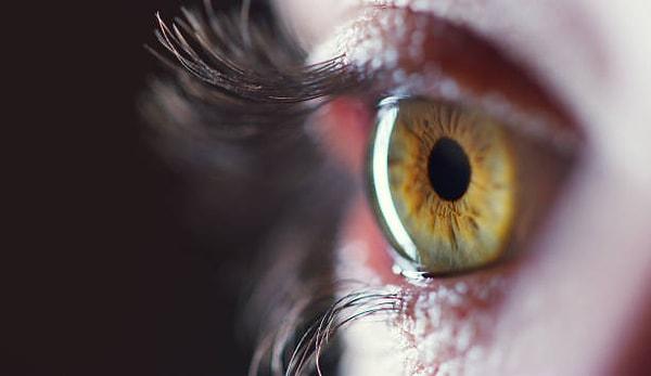 Bağışıklık sisteminin gözlere saldırması durumu nasıl oluyor?